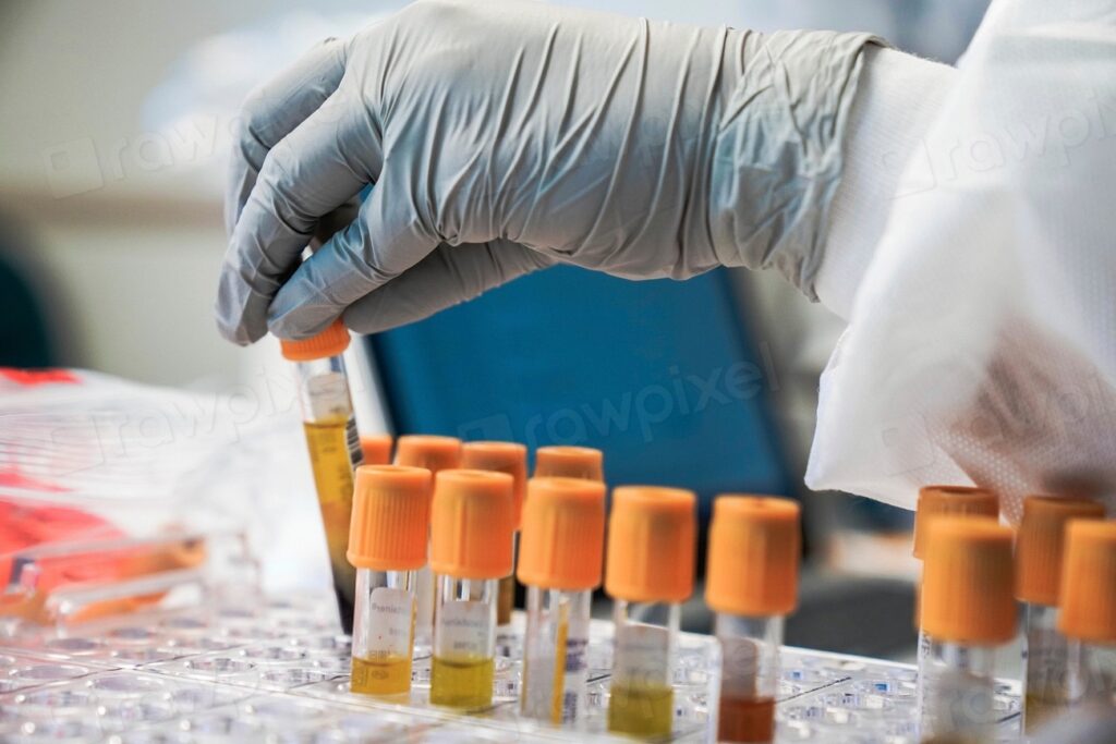 Blutprobe – NAD-Test